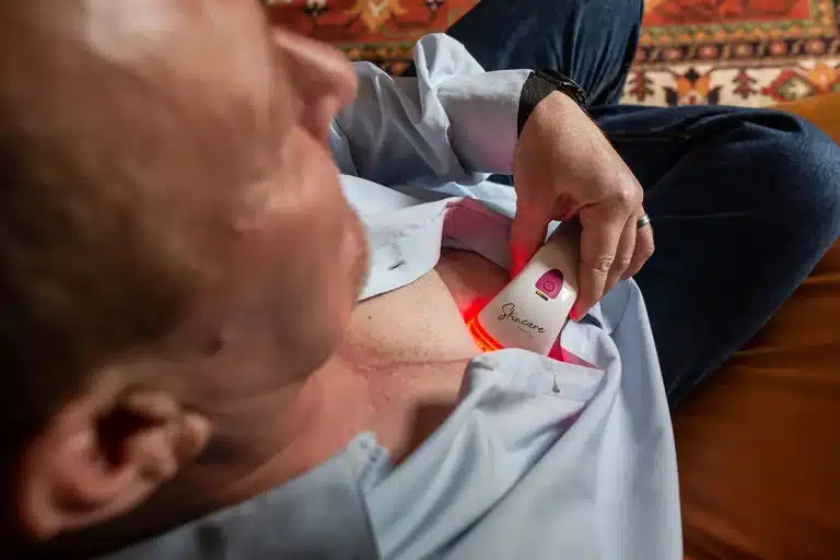 Photizo Skincare used on a scar on the chest
